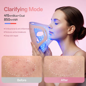 Graart three wavelengths support varied skincare needs