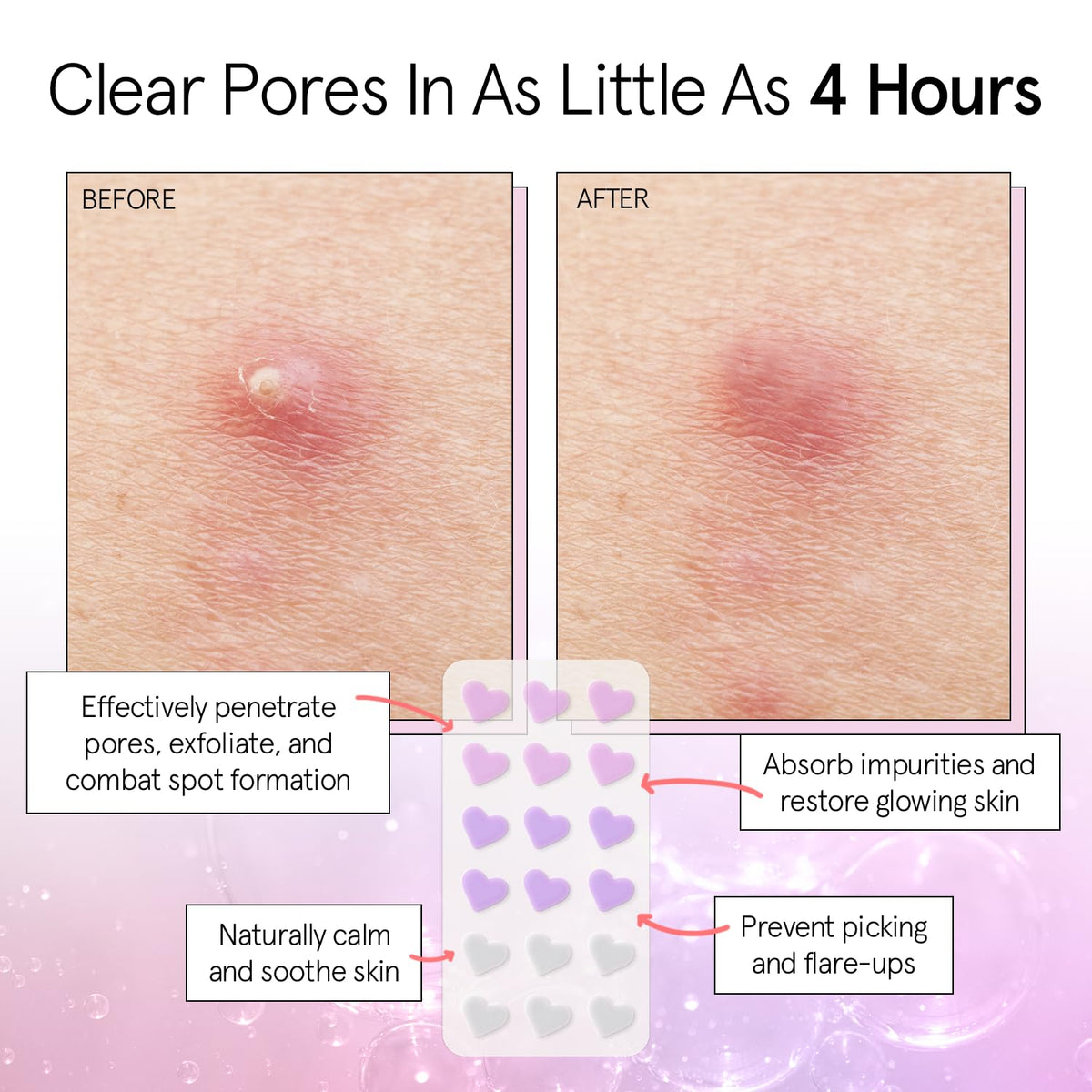 Grace & Stella heart patch clear pack blends with skin for discreet coverage.