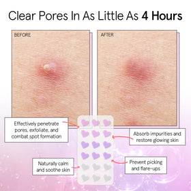 Grace & Stella heart patch clear pack blends with skin for discreet coverage.