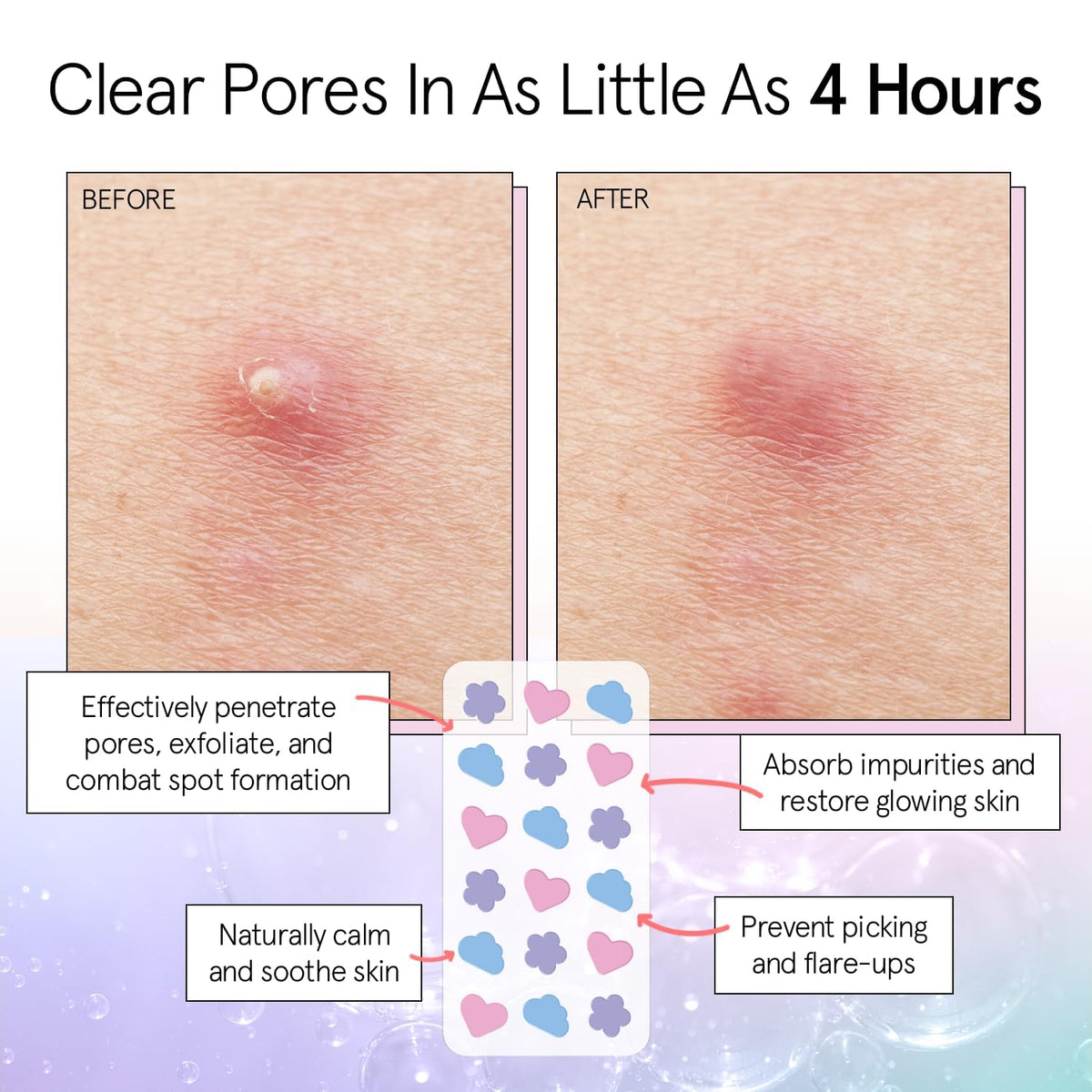 Closeup of Grace & Stella patch absorbing fluid to target breakouts.