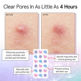Closeup of Grace & Stella patch absorbing fluid to target breakouts.