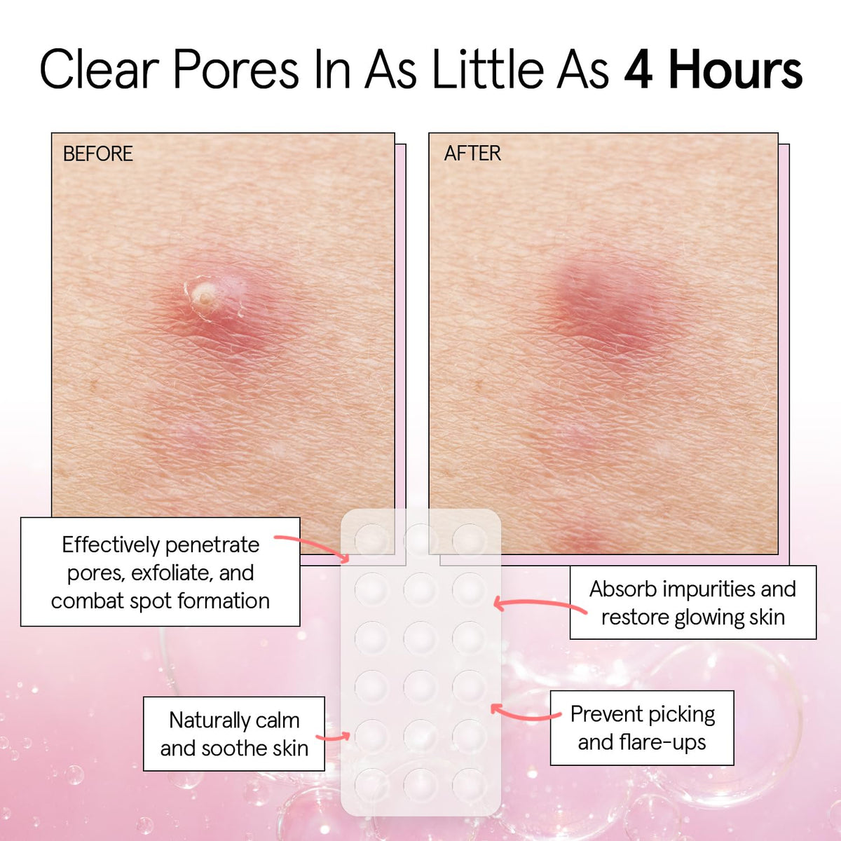 Grace & Stella 10mm patch for small pimples almost invisible