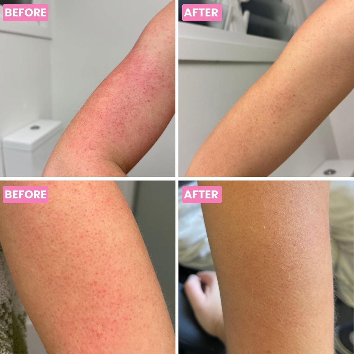 Grahams Natural KP Cream on-arm texture shows quick absorption