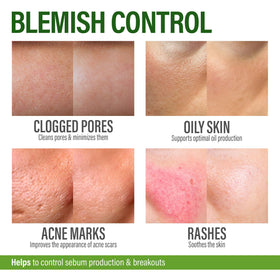 GRAMRIGHT Tea tree oil application on skin for spot treatment.