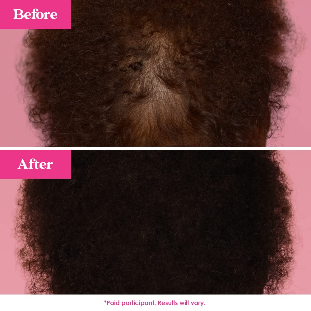 Men and women using GrandeHAIR serum for fuller-looking hair.