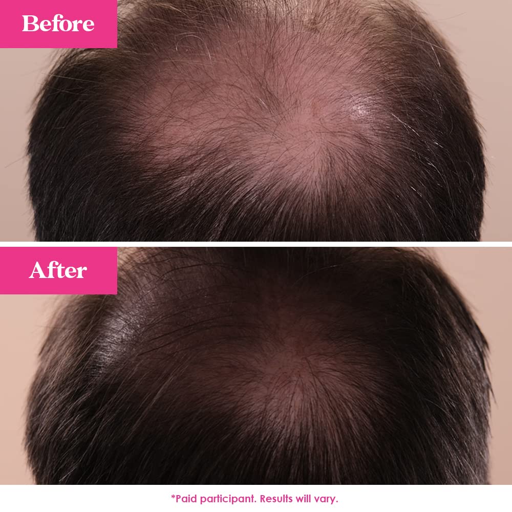 Concept image of thicker, stronger-looking hair with GrandeHAIR serum.