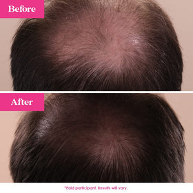 Concept image of thicker, stronger-looking hair with GrandeHAIR serum.