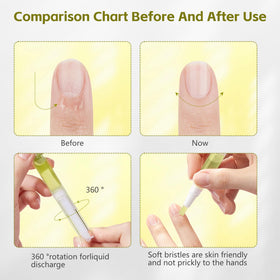 Grenben Nailz Growth Pen bottle close-up for convenient oil application.