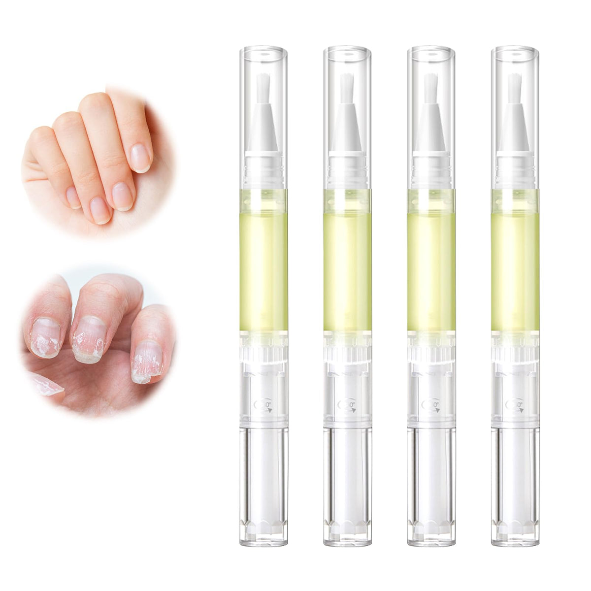 Grenben Nailz Growth Pen packaging shows the four-piece kit for home use.