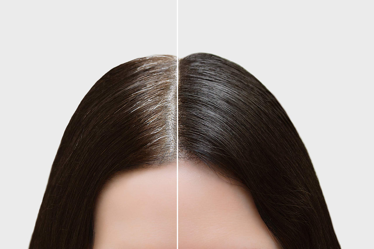 Greyfree hairlines color creates seamless blending with existing hair.