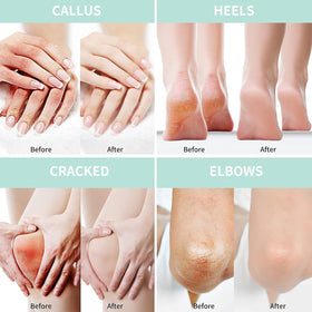 Grocerism Urea Cream shows tea tree and aloe for soothing skin