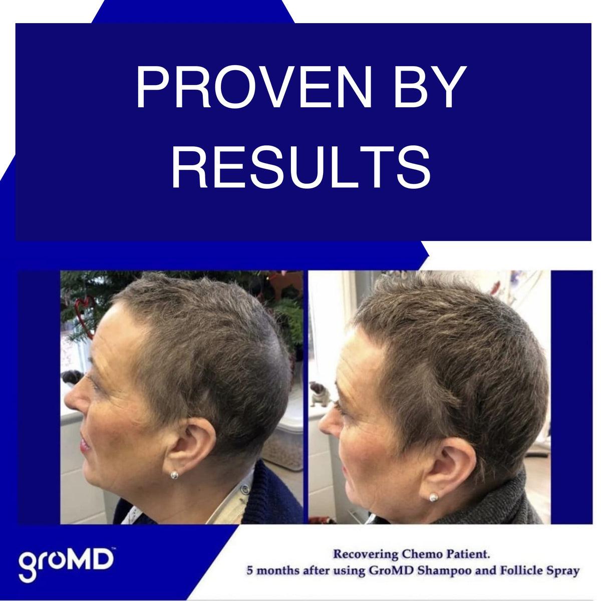 GroMD Biotin Shampoo foam lather delivering refreshing cleansing