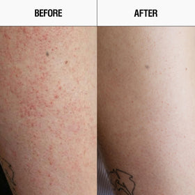 Close-up of the Resurfacing Targeted Body Cleanser label with active acids.