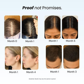Growplex bundle display showing the daily duo for fuller-looking hair.