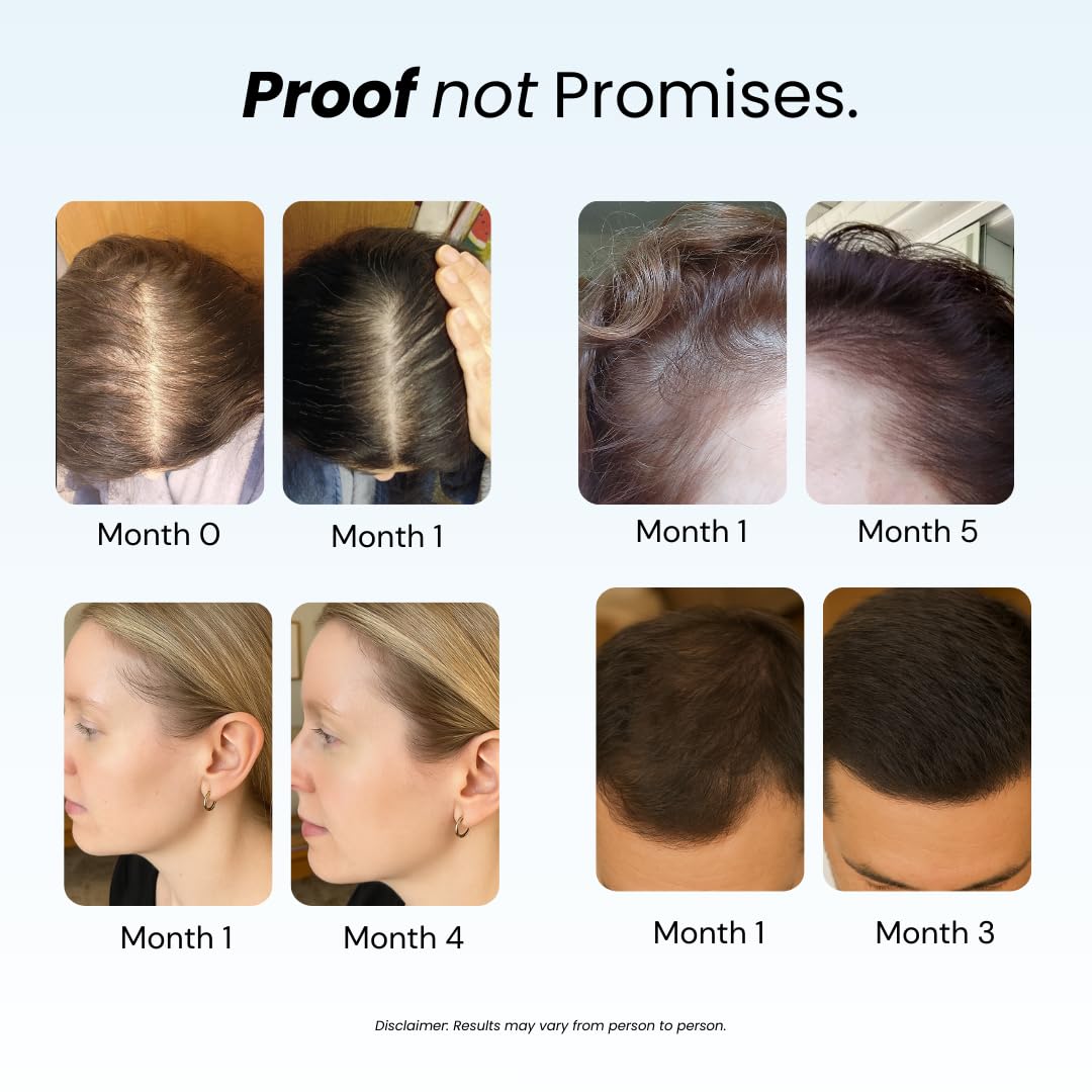 Growplex Replenish texture close-up showing creamy, lightweight hydration for all hair types.