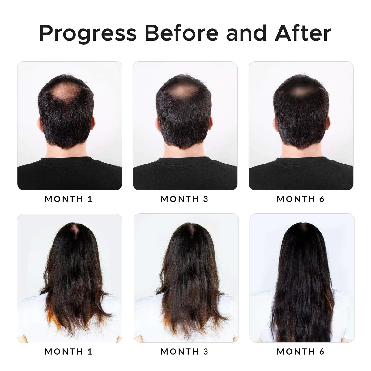 Growth Essence caffeine boost image conveys energizing scalp care