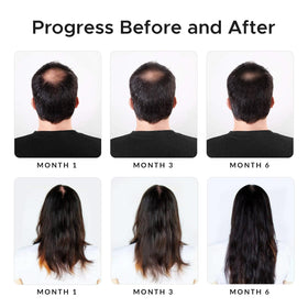 Growth Essence caffeine boost image conveys energizing scalp care
