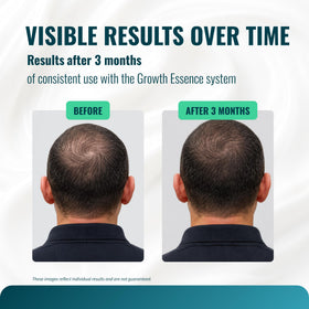 Growth Essence fragrance-free label indicating sensitive-skin friendly formula.