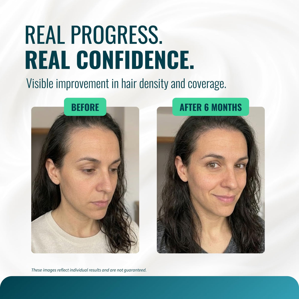 Growth Essence precision-cream application for controlled placement.