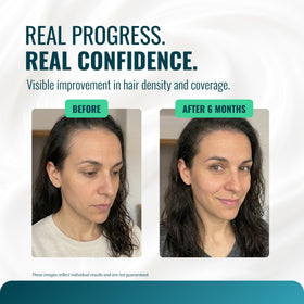 Growth Essence precision-cream application for controlled placement.