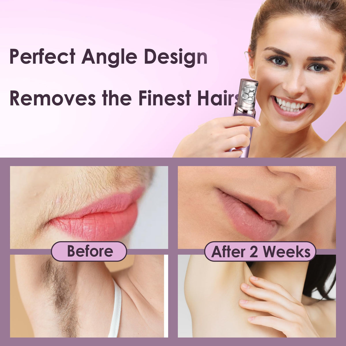 Gurelax LED light epilator for better visibility during removal.