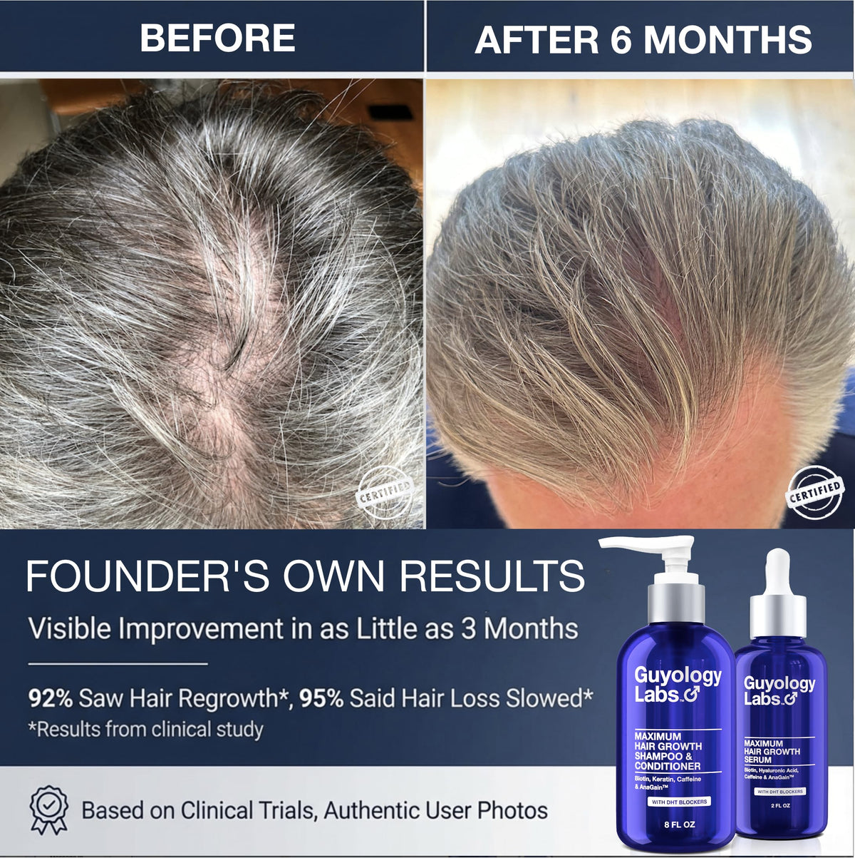 Guyology Labs Shampoo label emphasizes 2% AnaGain and caffeine for scalp activity.