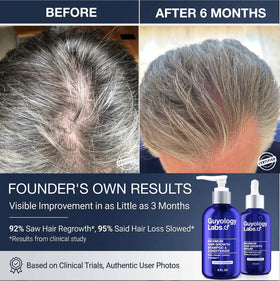 Guyology Labs Shampoo label emphasizes 2% AnaGain and caffeine for scalp activity.