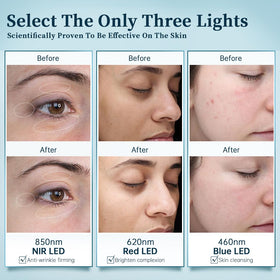 GYH LED face mask high-energy lamp beads enable shorter treatment sessions.