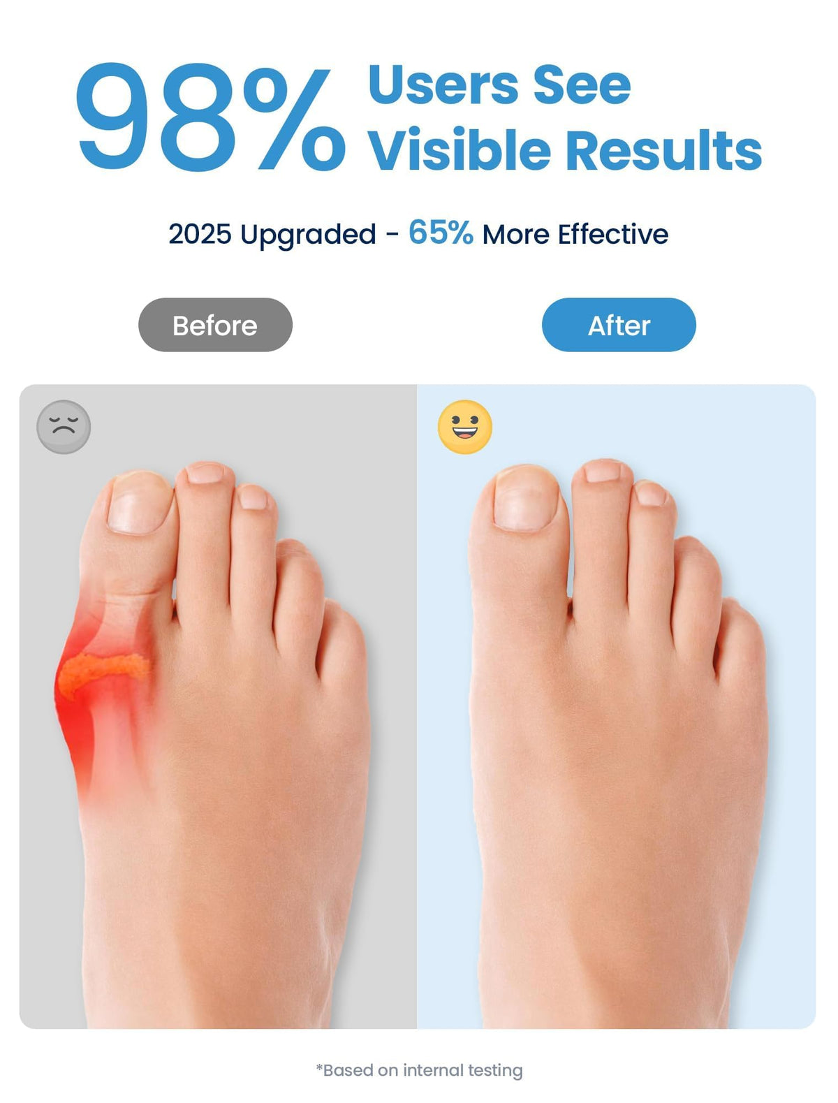Habioer bunion-corrector unisex-fit product on a foot for daily comfort.
