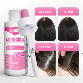 Hair Regen Minoxidil bottle shown for at-home daily use.
