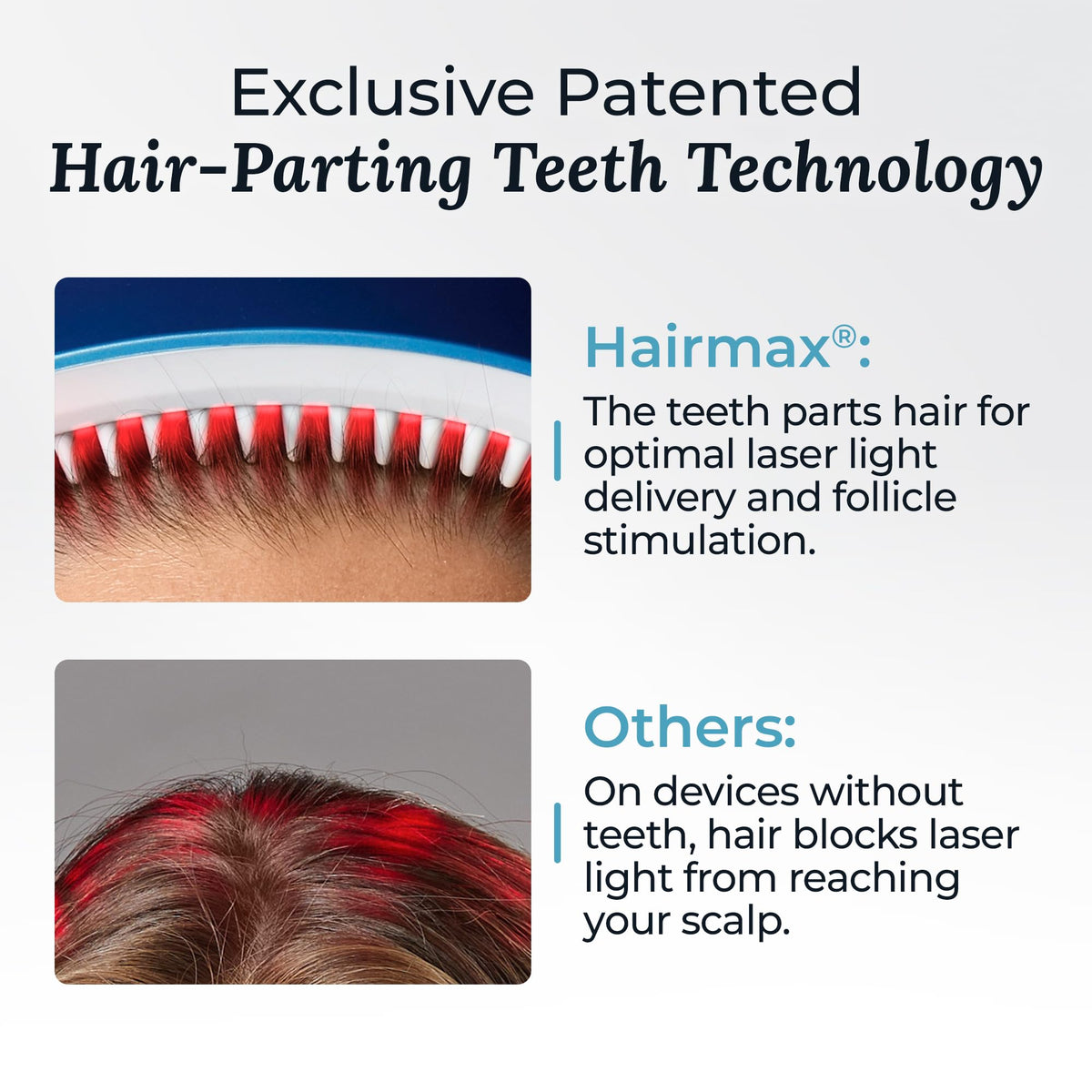 Hairmax LaserBand 82 charging cradle for convenient recharging
