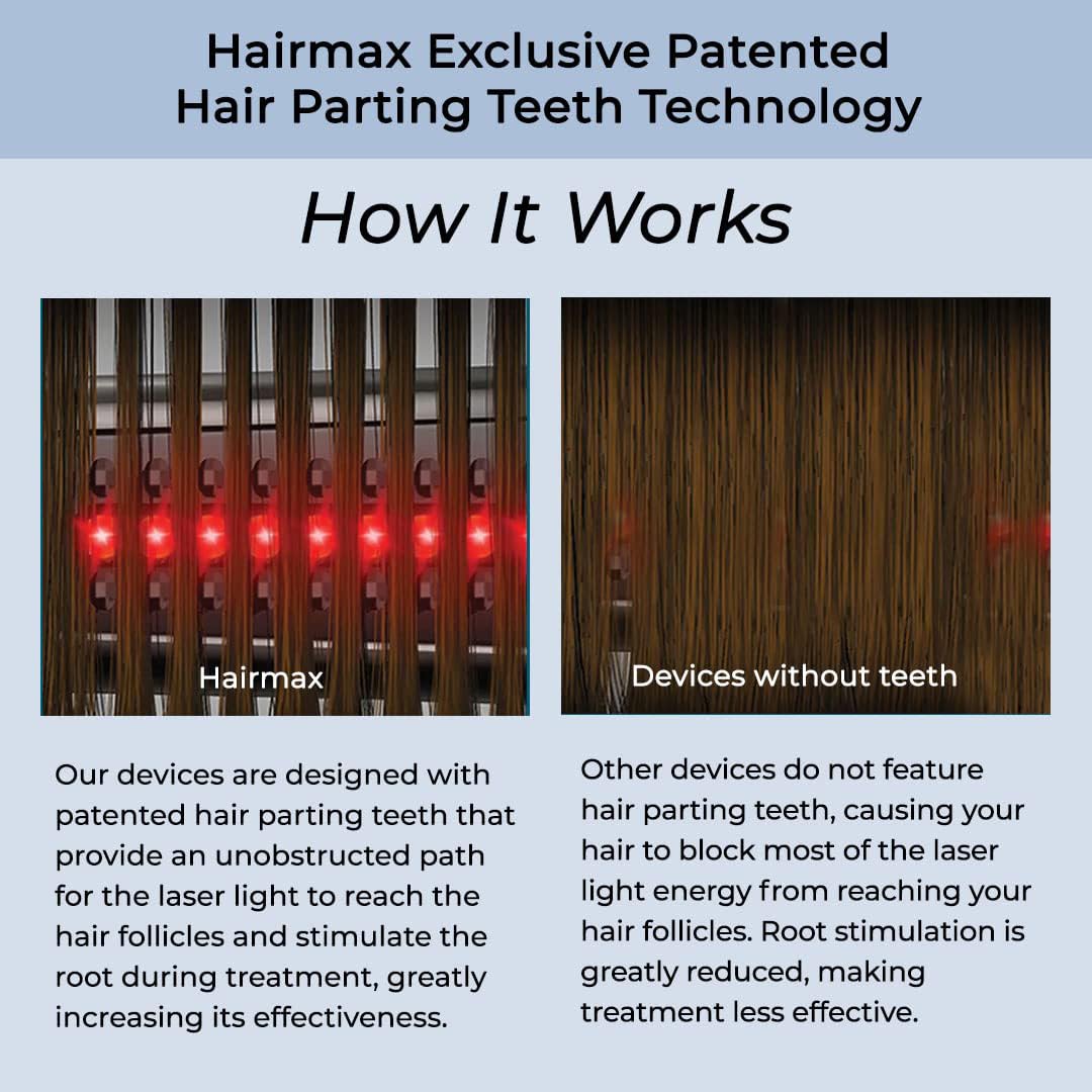 Hairmax Ultima12 Classic LaserComb safe red-light therapy highlight for scalp care.