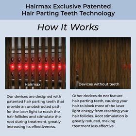 Hairmax Ultima 9 Classic shows clinical validation across studies.