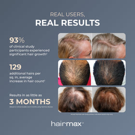 Hairmax Ultima 9 Classic exclusive hair-parting teeth for precision scalp work.