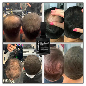 Hairo Hair Density Filler bald-spot coverage in seconds for thinning areas and confidence.