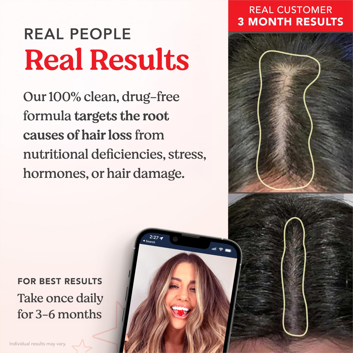 Ingredients list featuring biotin and zinc for hair health support.