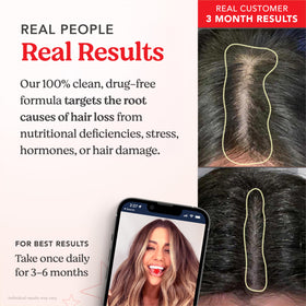 Ingredients list featuring biotin and zinc for hair health support.