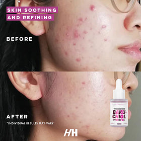Handmade Heroes 2percent bakuchiol serum closeup highlights texture and smoothing potential.