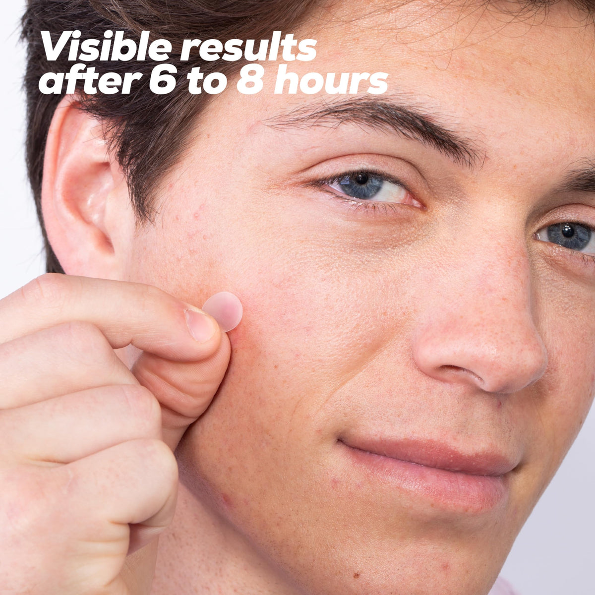 Hanhoo blind-pimple patch applied to underground blemish to protect