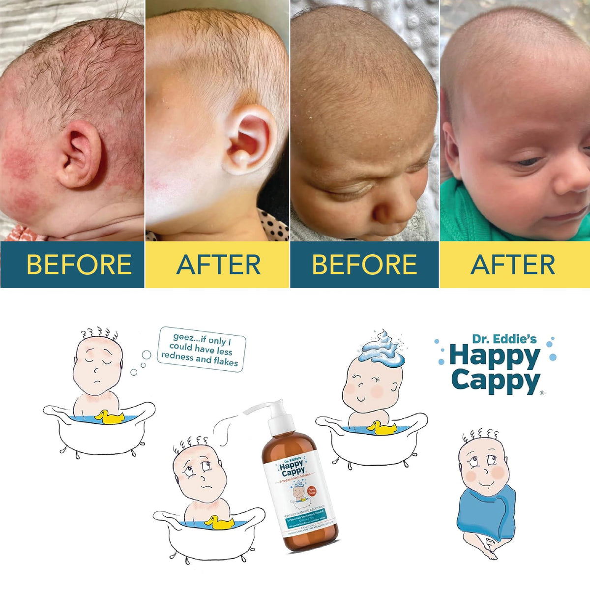 Happy Cappy kids bath time scene with pediatrician-designed medicated shampoo.