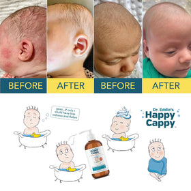 Happy Cappy kids bath time scene with pediatrician-designed medicated shampoo.
