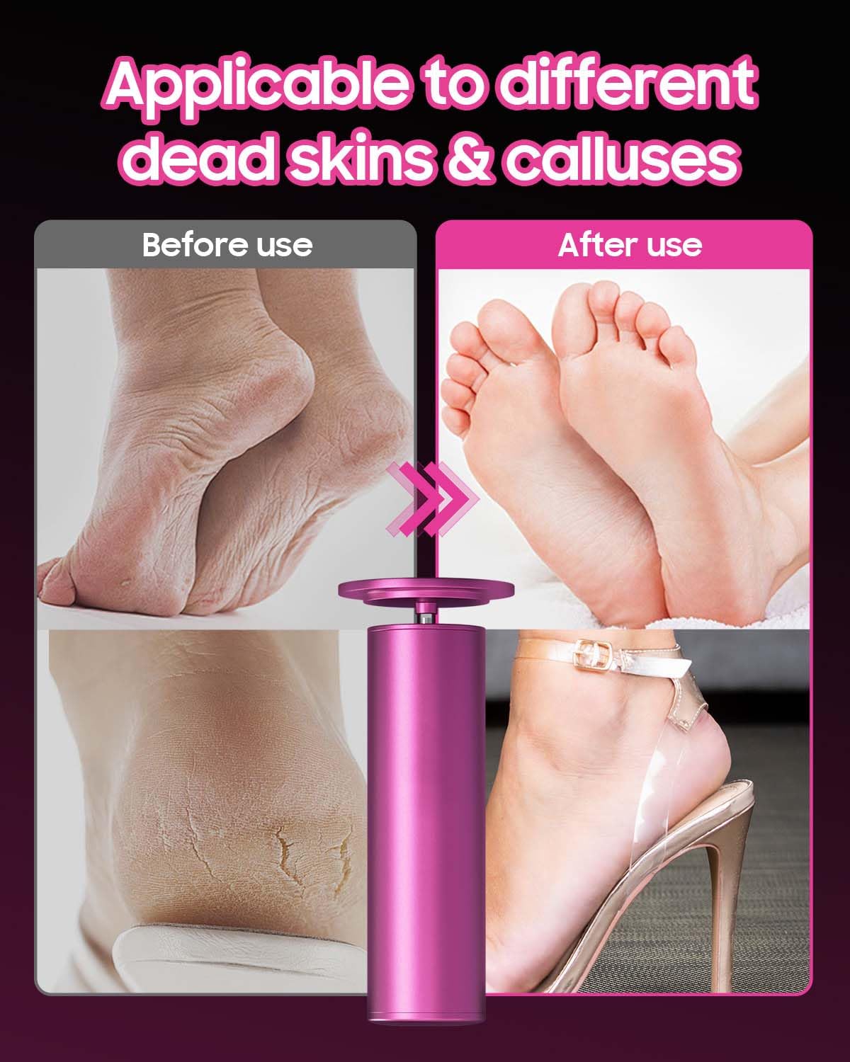 Professional-grade HayZBao foot file for at-home pedicures