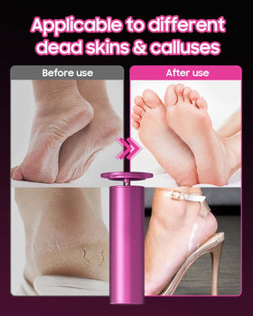 Professional-grade HayZBao foot file for at-home pedicures