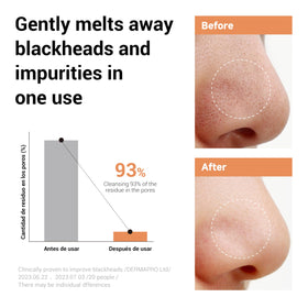 Close-up of eye and lip makeup removal with HEIMISH balm
