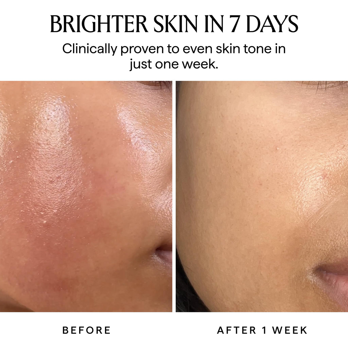 Herbivore Nova serum swatch showing turmeric infusion in warm light