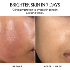 Herbivore Nova serum swatch showing turmeric infusion in warm light