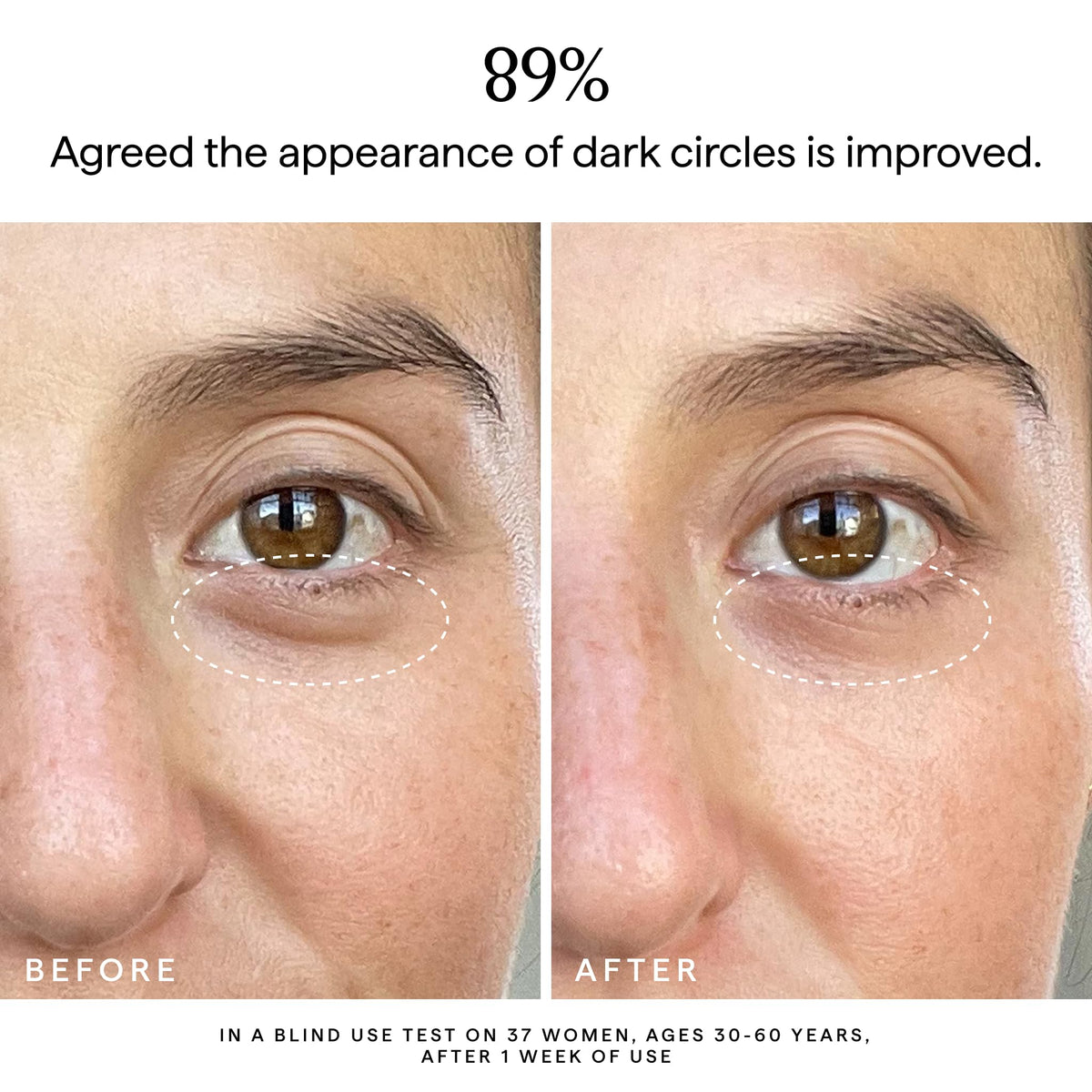 Turmeric-rich HERBIVORE Super Nova Eye Cream helps even tone and protect the under-eye area.