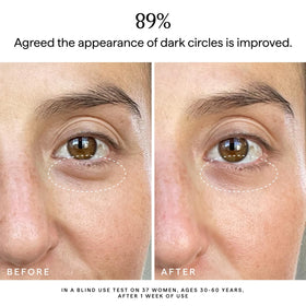 Turmeric-rich HERBIVORE Super Nova Eye Cream helps even tone and protect the under-eye area.
