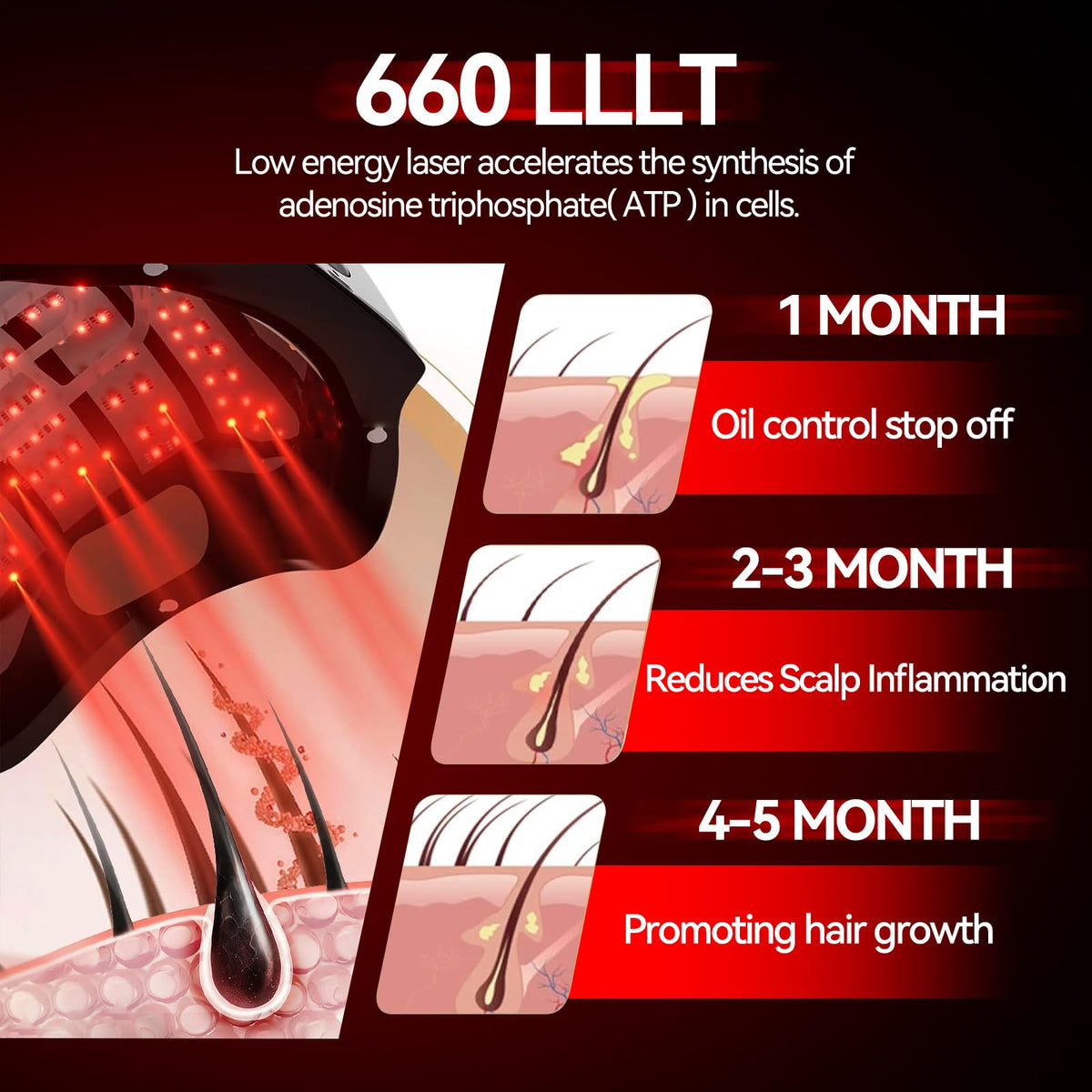 Herean Laser Cap highlights coverage of hairline, crown, and temples.