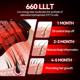 Herean Laser Cap highlights coverage of hairline, crown, and temples.